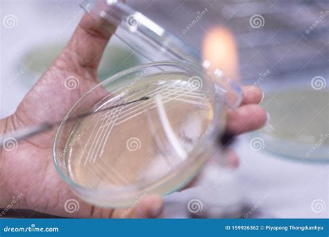 Colony Characteristics of Yeast in Petri Dish. Stock Photo - Image of education, eukaryotic ...