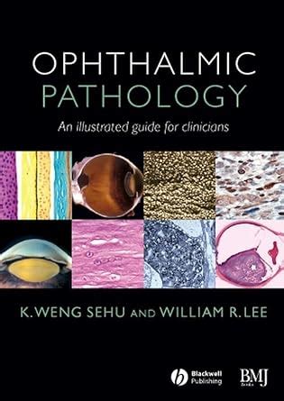 Buy Ophthalmic Pathology: An Illustrated Guide for Clinicians Book ...