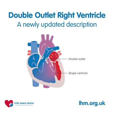 Double Outlet Right Ventricle - Youth Zone | Little Hearts Matter
