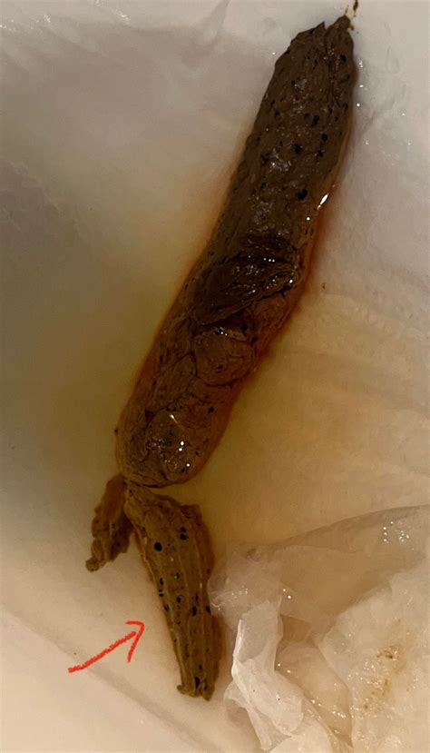 Black specks in stool : r/poop