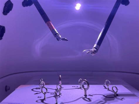 Image result for Robotic Partial Nephrectomy Video Animation