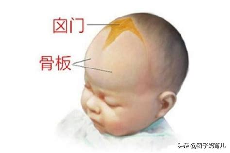 婴儿头骨两侧有缝图片,宝宝颅缝分离图片,婴儿头一侧骨缝明显_大山谷图库