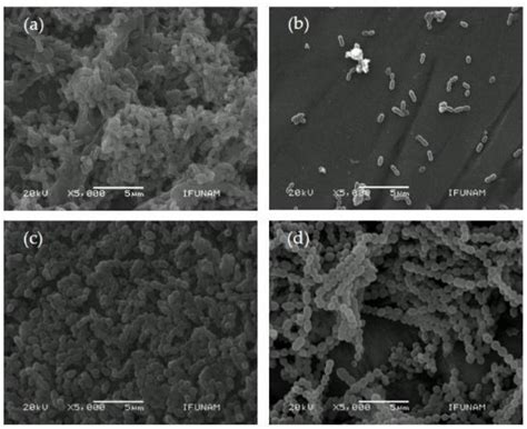 Effect of Surface Roughness of Deciduous and Permanent Tooth Enamel on ...