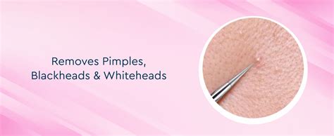 GUBB Pimple, Acne And Blackhead Remover Tool | Face Skin Care Kit ...