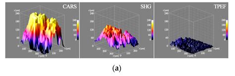 In Vitro Study of Extracellular Vesicles Migration in Cartilage-Derived ...