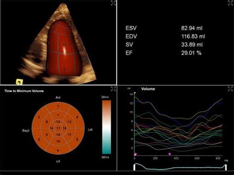 Ultrasound Machines - Siemens Healthineers India