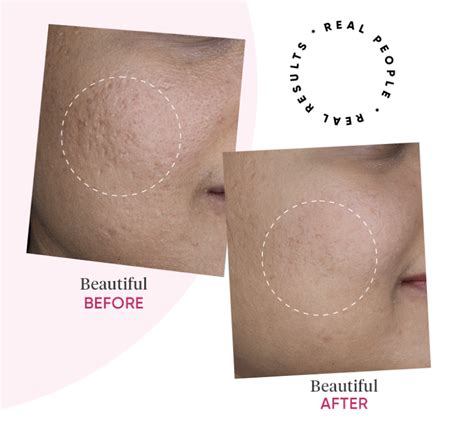 Vitamin E + Peptide Moisturizer with SPF 30 by Dot & Key