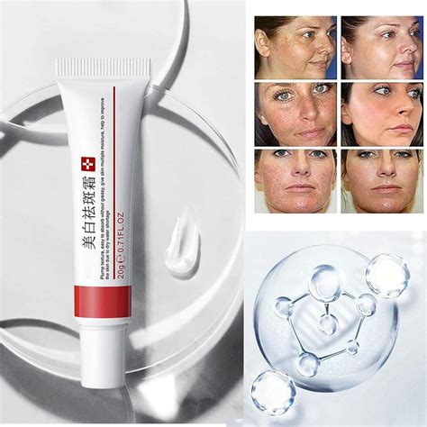 Pimaup Tranacix Crema Manchas, Crema Para Las Manchas India | Ubuy