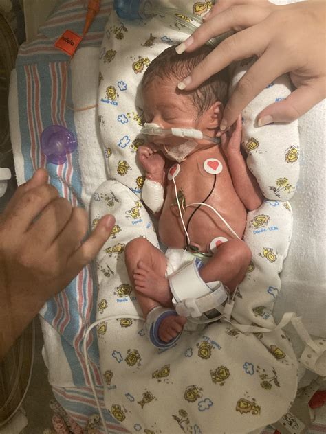 My little girl Isabella was born at 29 weeks a lil over a week ago 💗she ...
