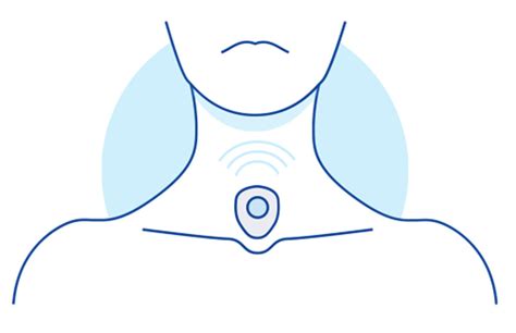 Automatic Heart Rate Detection during Sleep Using Tracheal Audio ...
