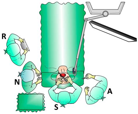 High-Definition 3D Exoscope-Assisted Barbed Pharyngoplasty for OSAS and Snoring: Better Than Live