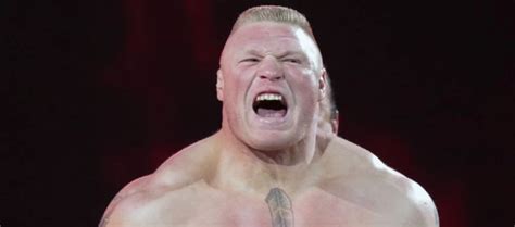 WWE Brock Lesnar Teeth Fixed Now? Before and Afters | LEMA