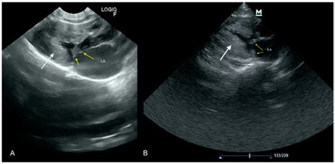 Focused Cardiac Ultrasound Examination as a Tool for Diagnosis of ...