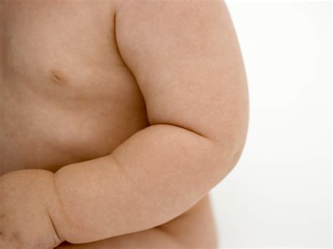 Dislocated shoulder | BabyCenter