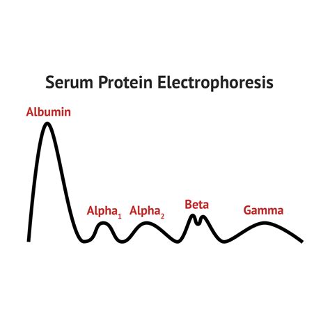 Elevated Protein Electrophoresis at Karen Batey blog