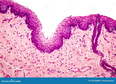 What Are Pseudostratified Squamous Epithelium at Oliver Gonzalez blog