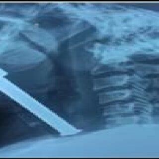 soft tissue X ray neck (lateral view) | Download Scientific Diagram