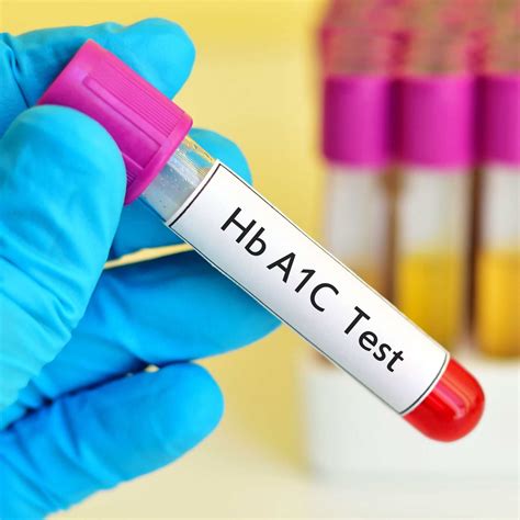 A1C: Questions from a Diabetes Practice | ADW Diabetes