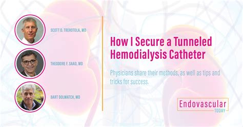 Hemodialysis Tunneled Catheter