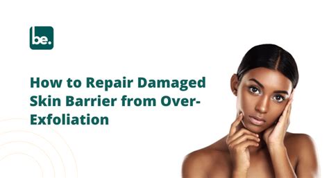 How to Repair Damaged Skin Barrier from Over-Exfoliation – Belogical ...