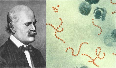 The sad destiny of Ignaz Semmelweis - "The savior of mothers" | The ...