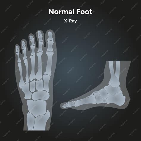 Premium Vector | Normal foot xray