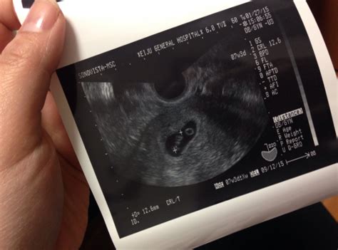 孕7个月胎儿发育过程详解！ - 哔哩哔哩