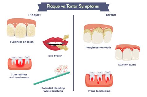 How To Clean Plaque Off Teeth & Keep It Off | Removing Plaque