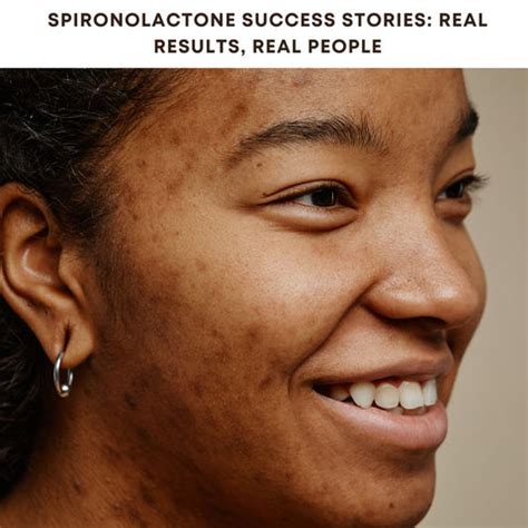 How Spironolactone Treats Acne: Benefits and Dosage | Clinikally