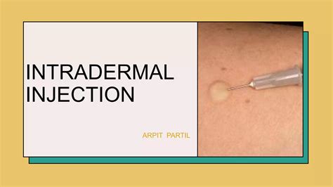 INTRADERMAL INJECTION.pptx