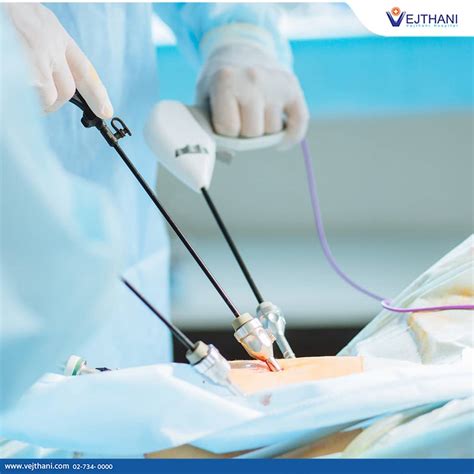 Appendicitis Laparoscopic Surgery – PING