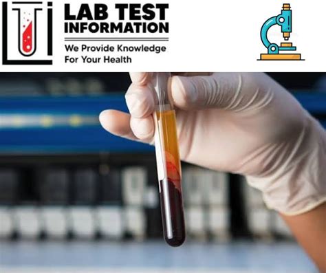 Image result for Prothrombin Time Normal Result