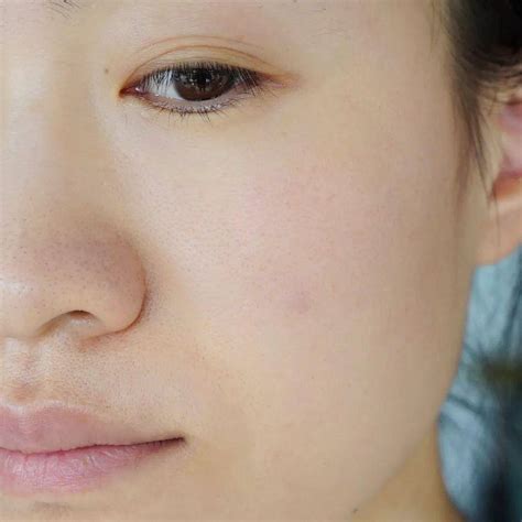 肤色发黄脸色发黄暗沉是什么原因引起的2022已更新今日动态