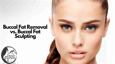 Buccal Fat Removal Vs Botox at Jeremy Sanchez blog