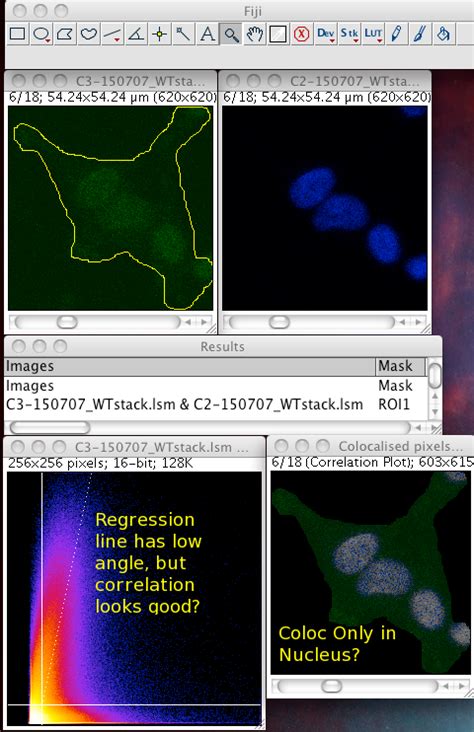 Image result for ImageJ Colocalization Coloc