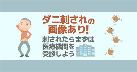 Image result for Button Code in HTML