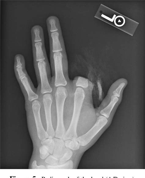 Image result for Snapping Turtle Bites