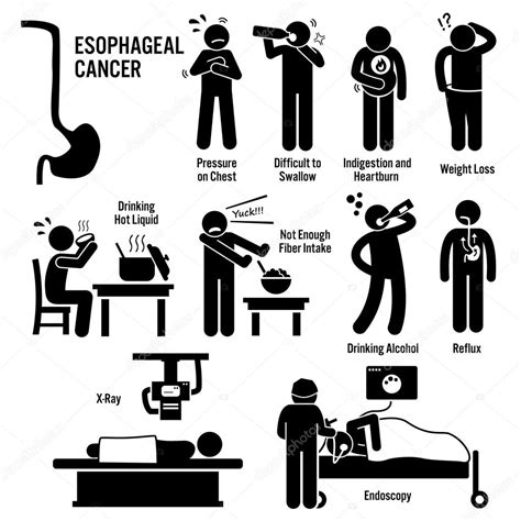 Esophageal Esophagus Throat Cancer Symptoms Causes Risk Factors Diagnosis Stick Figure Pictogram ...