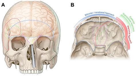 Anterior Cranial Fossa