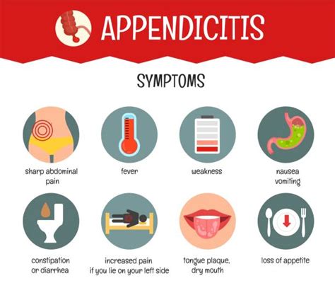 Image result for Appendicitis