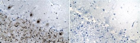 Anti-CUX1 Antibody, clone 1J18 ZooMAb Rabbit Monoclonal Sigma-Aldrich