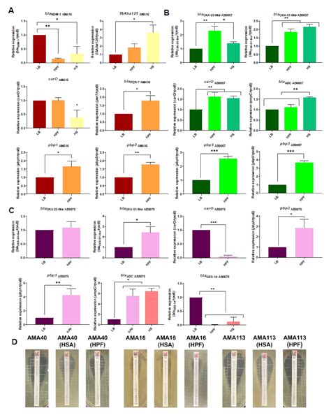 Human Serum Proteins and Susceptibility of Acinetobacter baumannii to ...