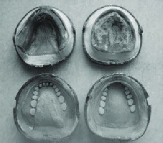 Image result for Separating Flask