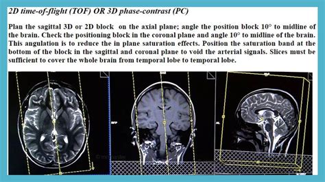 Magnetic Resonance Angiography and Venography | PPTX
