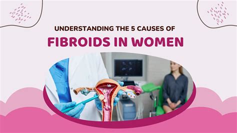UNDERSTANDING THE 5 CAUSES OF FIBROIDS IN WOMEN | PDF