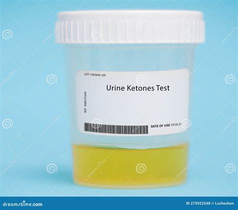 Fat In Urine