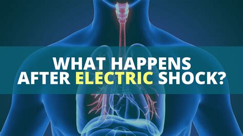 Electric Shock After Pain at Dennis Fleming blog