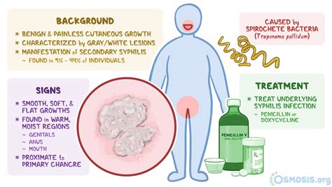 Condylomata Lata: What Is It, Cause, Presentation, and More | Osmosis