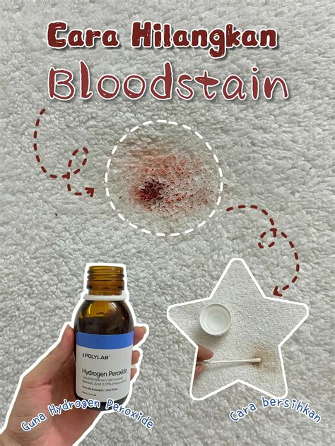 Life Hack ! Remove Blood Stain ! | Galeri disiarkan oleh Marshanuffa ...