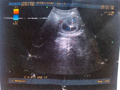 胎儿3个月、6个月、9个月的变化，看完惊喜又感动，你期待吗？_肚子